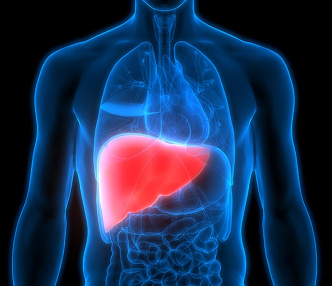 Understanding Fatty Liver Disease: Causes, Symptoms, and Prevention