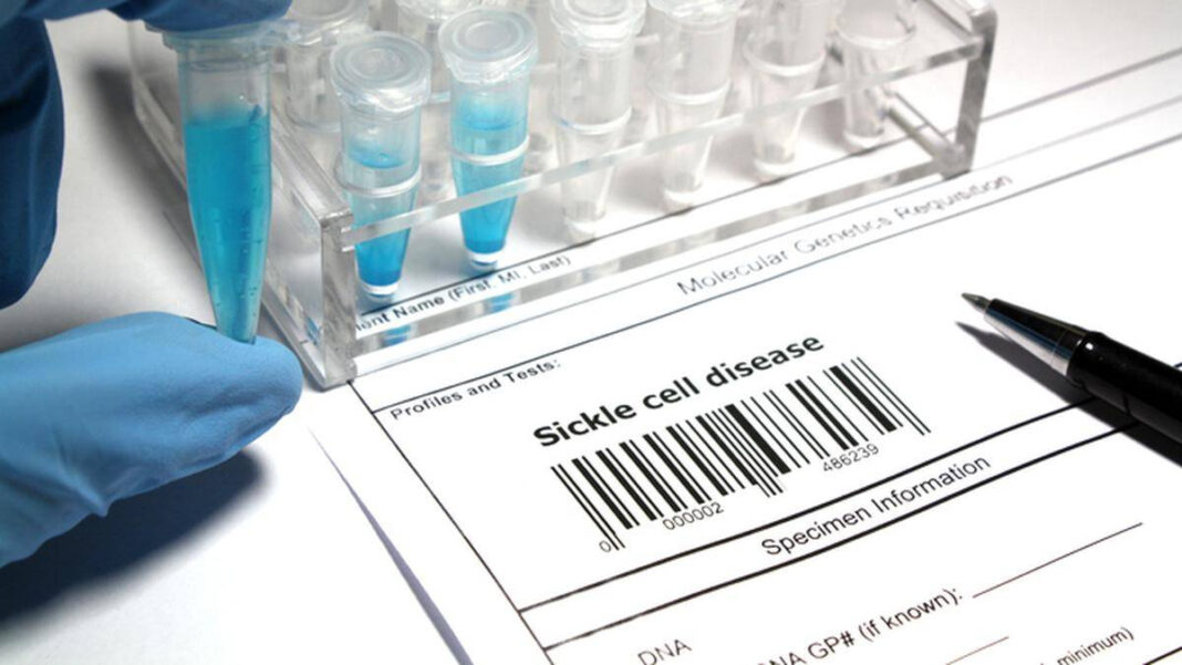 Experts in Odisha Advise Matching Sickle Cell Status Over Horoscopes Before Marriage "Odisha Experts Recommend Sickle Cell Status Checks Over Horoscopes Before Marriage"