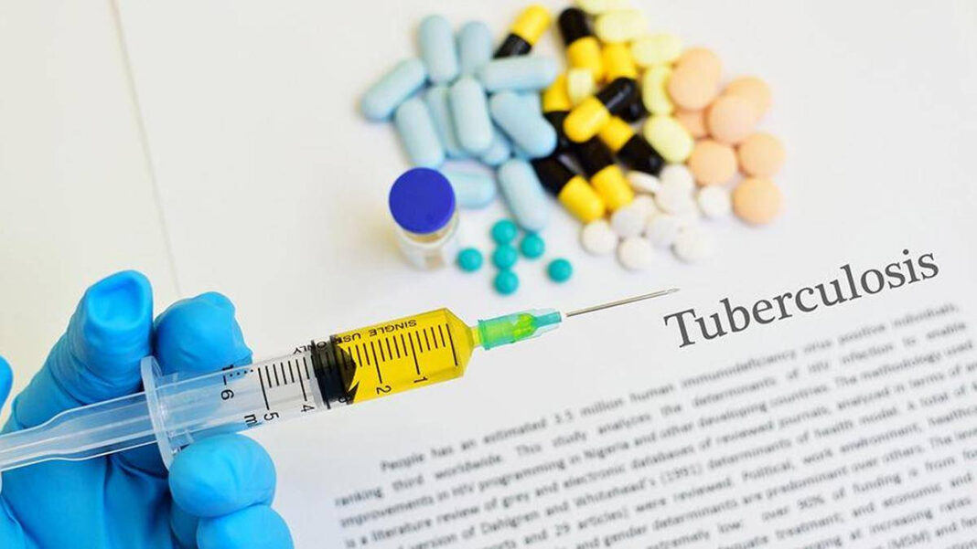2,390 Gram Panchayats in Tamil Nadu Declared Tuberculosis-Free Toward 2025 Goal 2,390 Tamil Nadu Gram Panchayats Declared TB-Free Toward 2025 Goal